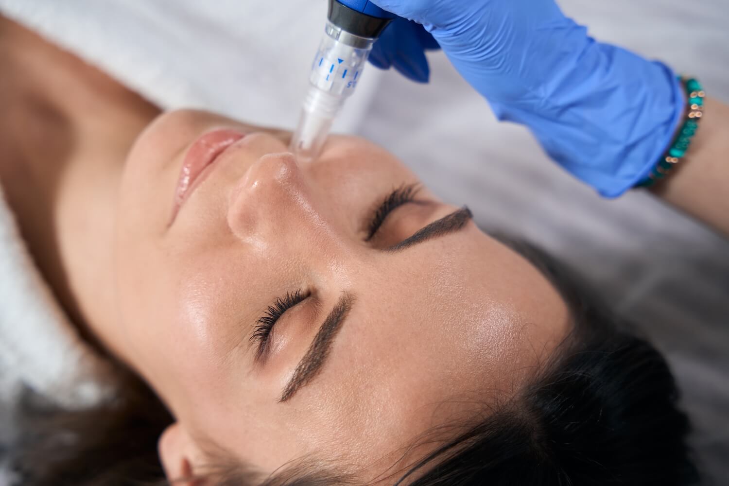 Why SkinPen Microneedling Is The Best Skincare Procedure for Anti-Aging