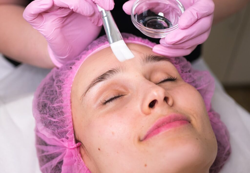 How Do Chemical Peels Work deep skin