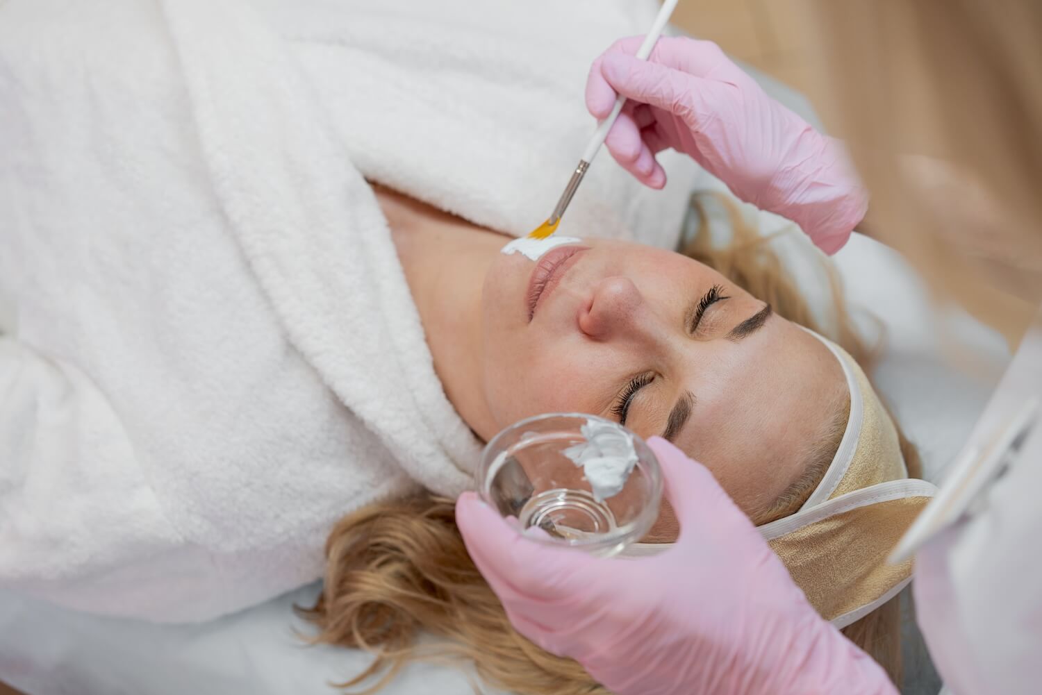 How Do Chemical Peels Work?