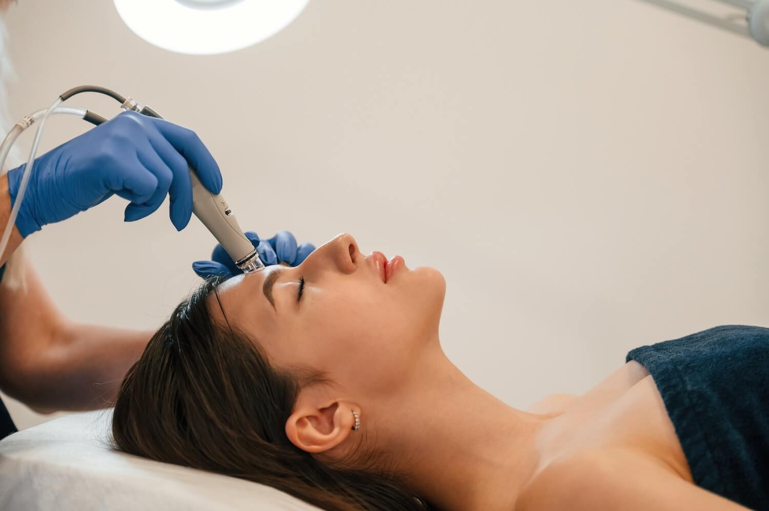 Are Chemical Peels or Microneedling Services Better For Your Skin?
