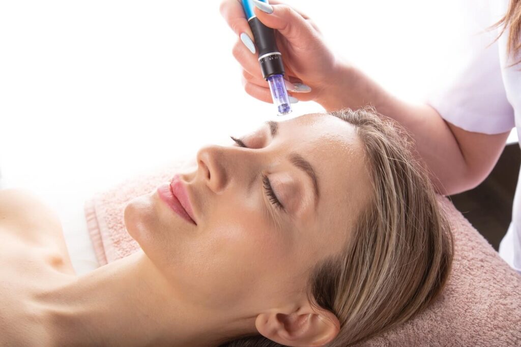 Why SkinPen Microneedling Is Becoming a Popular Choice For Noticably Better Skin skinpen benefits skin