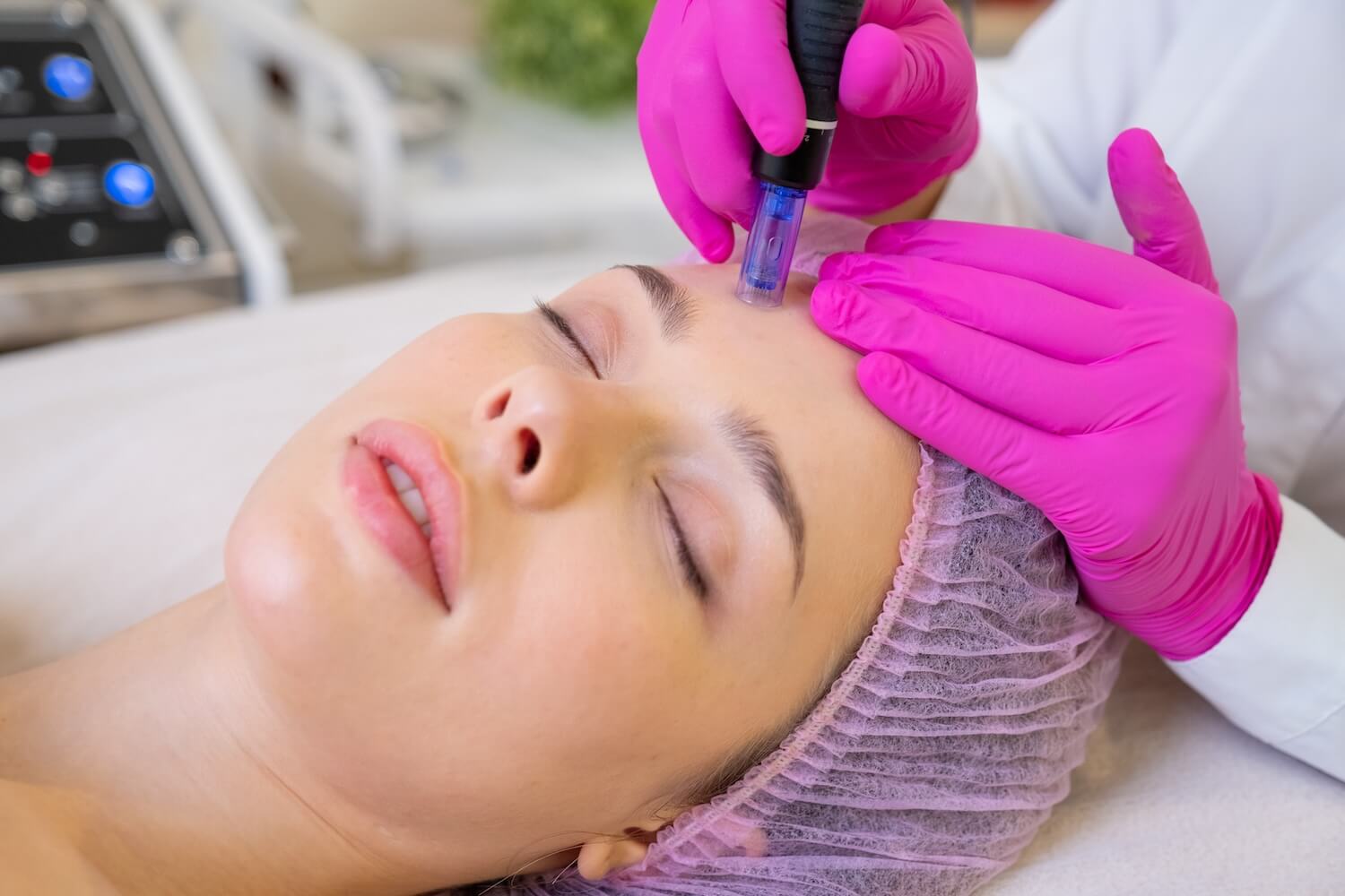 How Platelet Rich Plasma and Microneedling Work Together to Give You Your Best Skin healing natural