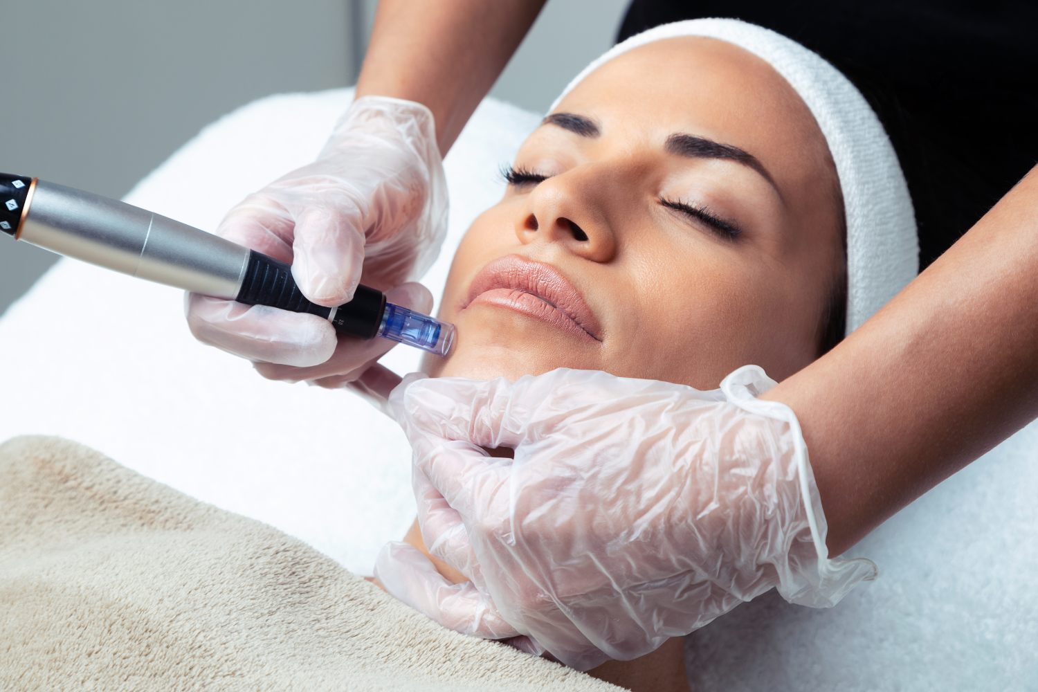 How Exosome Microneedling Boosts Collagen and Restores Youthful Skin