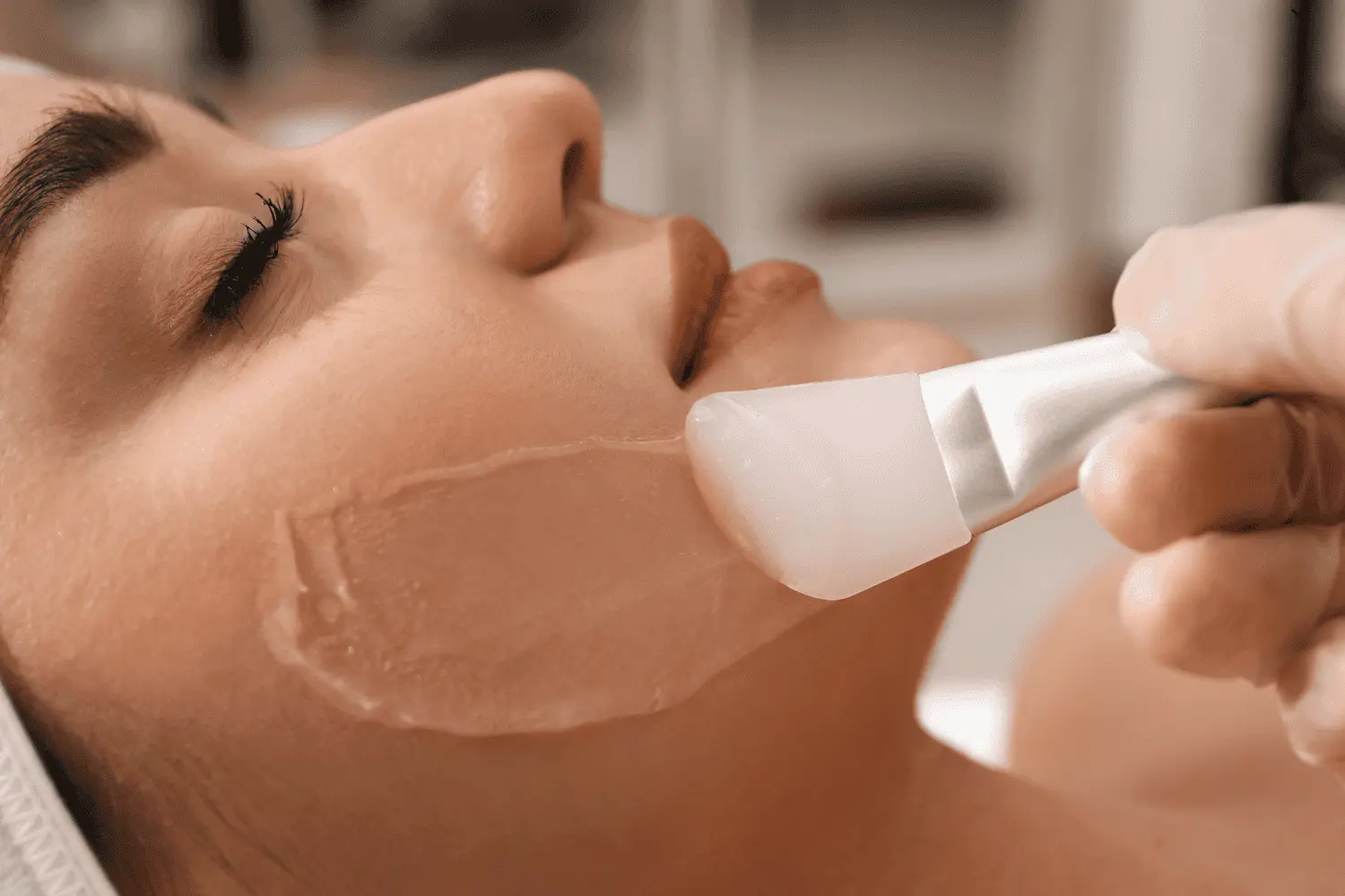 What to Expect Before, During, and After a Chemical Peel