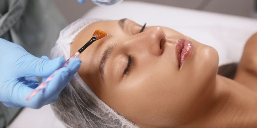 Chemical peels in Arlington VA for smoother, glowing skin