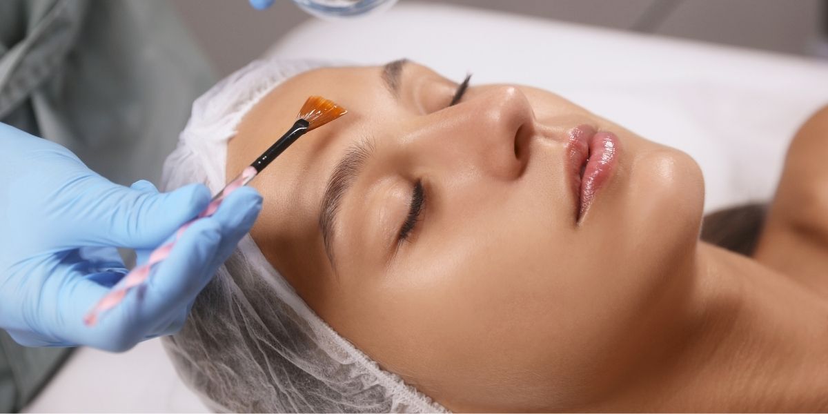 Chemical peels in Arlington VA for smoother, glowing skin
