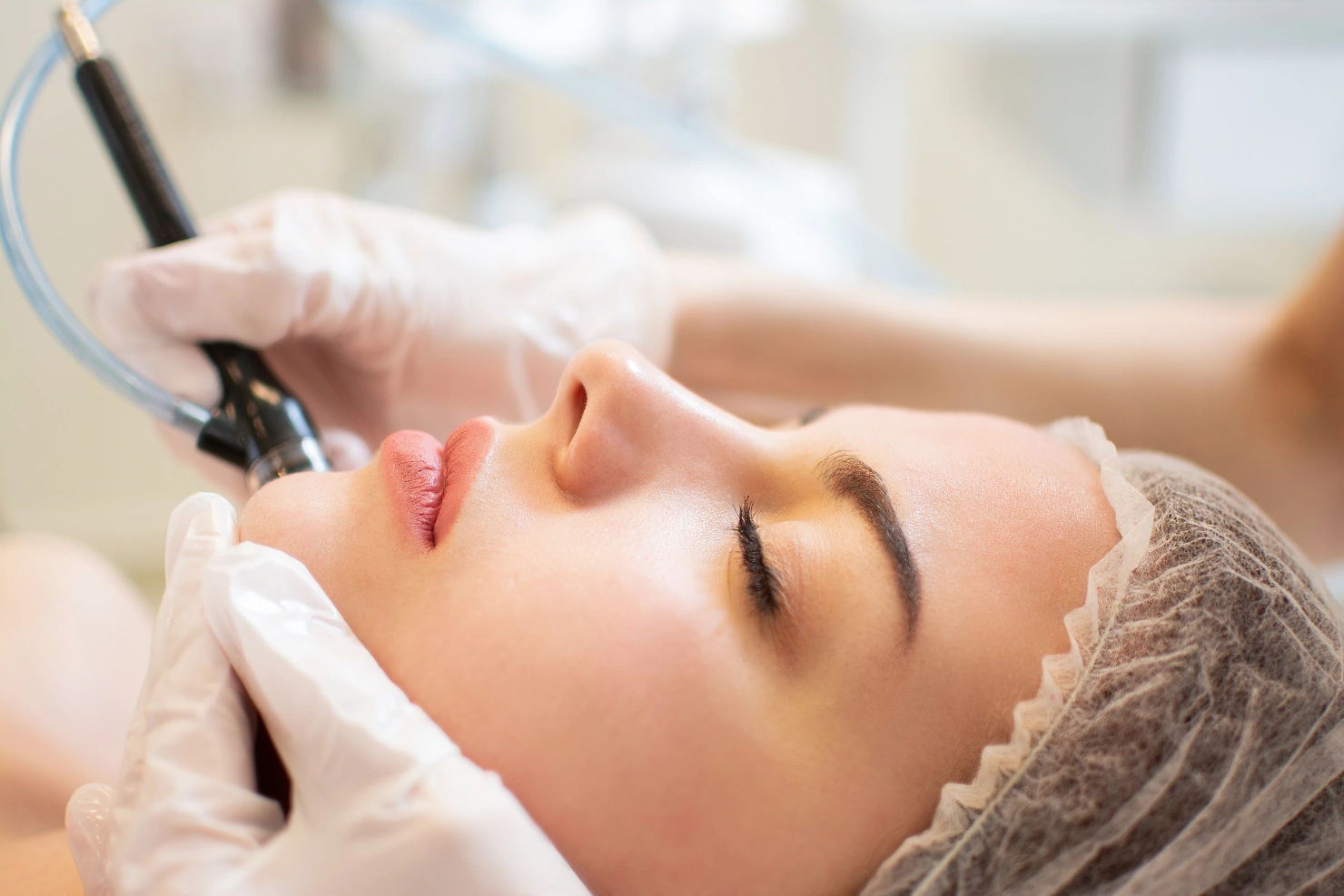 Hydrafacial For Acne-Prone And Congested Skin
