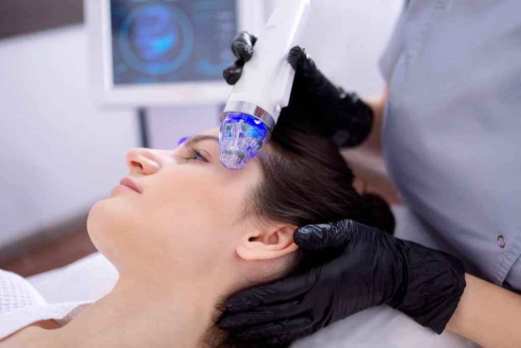 RF Microneedling For Crepey Body Skin And Early Skin Laxity