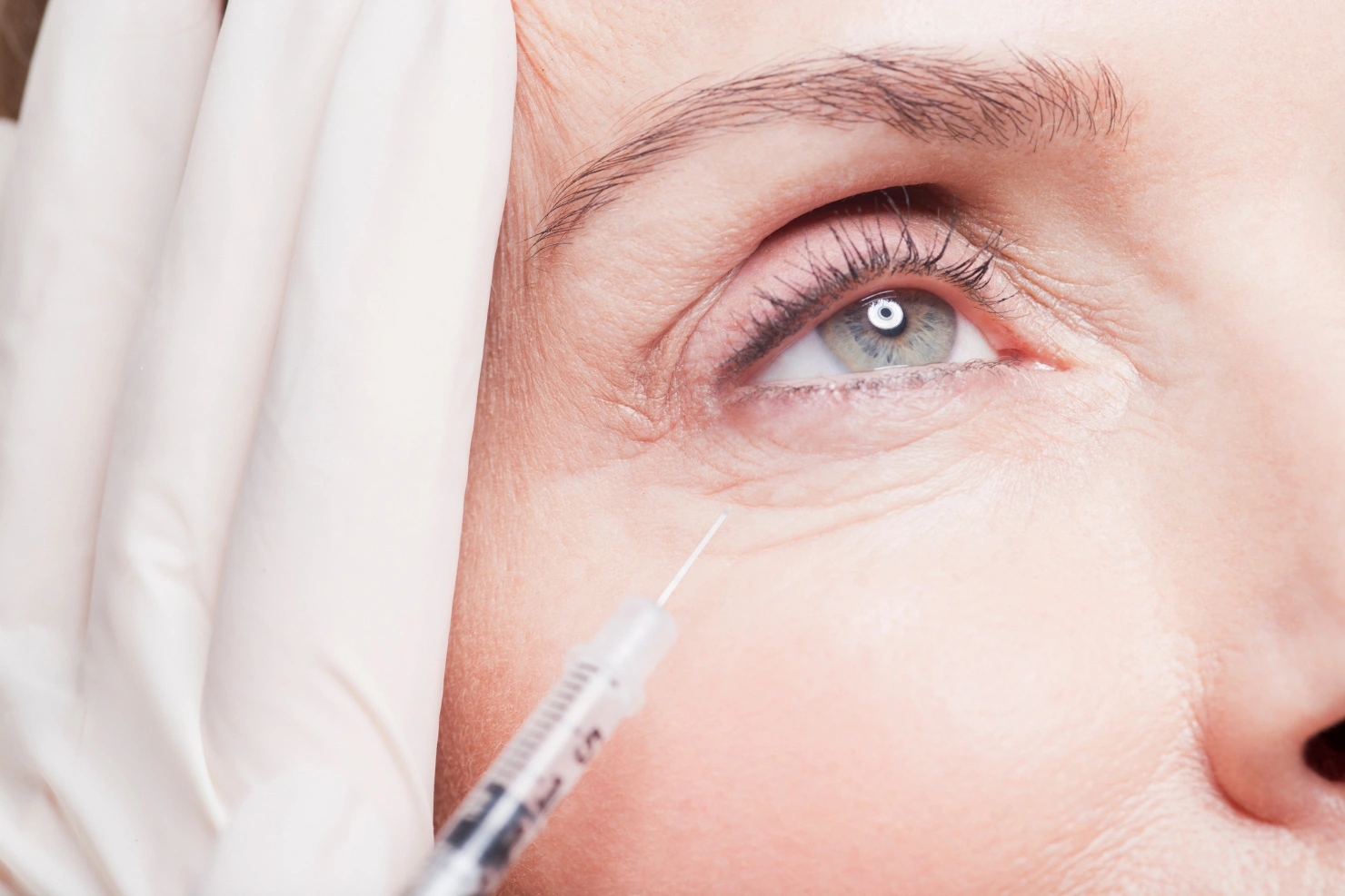 Under-Eye Dark Circles Have Different Causes and Need Different Solutions