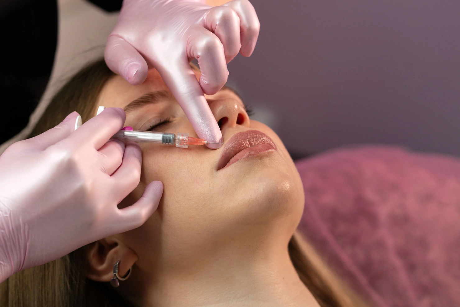 Thin Lips Do Not Always Need Dramatic Volume to Look Fuller
